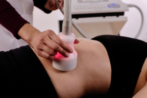 Cryoskin: The Future of Body Contouring and Sculpting