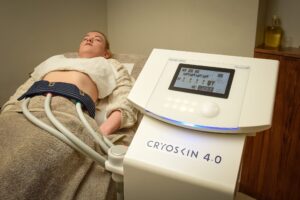 Cryoskin: The Future of Body Contouring and Sculpting